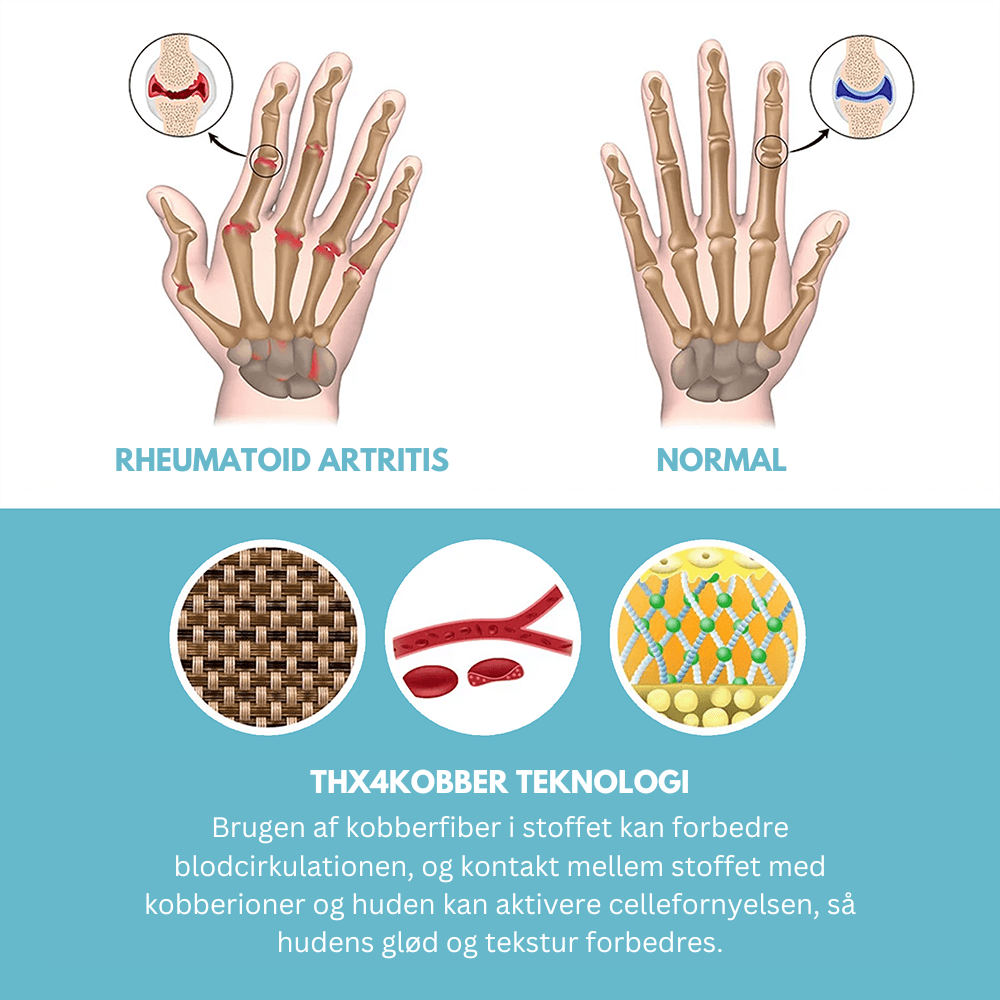 GripEase® | Få øjeblikkelig lindring af gigt og kroniske håndsmerter!